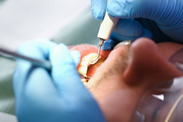 Best Same-Day Emergency Dental Services in Pawhuska, OK