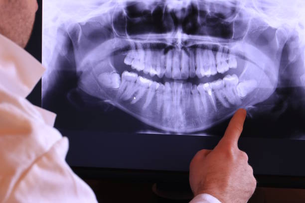 Best Urgent Care for Lost Fillings or Crowns in Pawhuska, OK