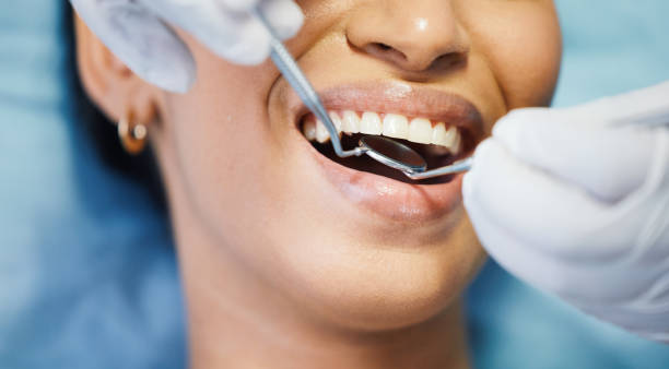 Best Emergency Treatment for Dental Infections or Abscesses in Pawhuska, OK