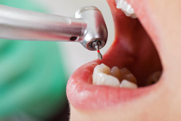Best Emergency Wisdom Teeth Removal in Pawhuska, OK